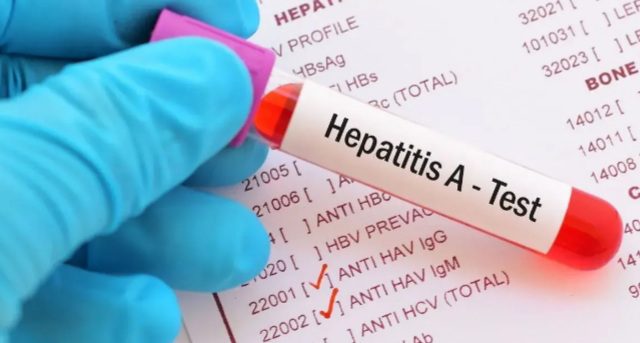 هشدار شیوع بالای هپاتیت A در کودکان و نوجوانان ایرانی