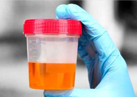 چرا ادرار مردان قرمز می‌شود؟