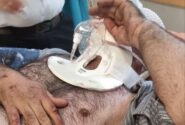 اورژانس تبریز جان مرد ۵۰ ساله حادثه‌دیده را نجات داد