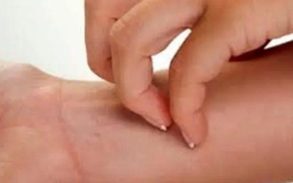 چرا برخی مواد غذایی حساسیت زا می شوند؟